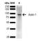 Axin 1 antibody, LS-C775204, Lifespan Biosciences, Western Blot image 