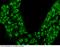 Calbindin 1 antibody, 102051-T46, Sino Biological, Immunohistochemistry paraffin image 