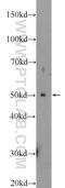 Parkin RBR E3 Ubiquitin Protein Ligase antibody, 14060-1-AP, Proteintech Group, Western Blot image 