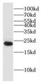 DnaJ Heat Shock Protein Family (Hsp40) Member C5 Beta antibody, FNab02467, FineTest, Western Blot image 