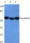 Checkpoint Kinase 1 antibody, A01060S286, Boster Biological Technology, Western Blot image 