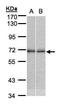 Nuclear Receptor Subfamily 2 Group C Member 2 antibody, GTX105119, GeneTex, Western Blot image 