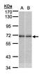 Tr4 antibody, GTX105119, GeneTex, Western Blot image 