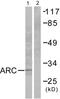 Nucleolar Protein 3 antibody, PA5-38097, Invitrogen Antibodies, Western Blot image 
