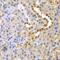 Glyoxalase I antibody, GTX55643, GeneTex, Immunohistochemistry paraffin image 