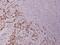 BCL2 antibody, PA5-36625, Invitrogen Antibodies, Immunohistochemistry paraffin image 