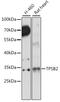 Tryptase Beta 2 (Gene/Pseudogene) antibody, 16-301, ProSci, Western Blot image 