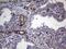 TRNA Methyltransferase 12 Homolog antibody, MA5-27176, Invitrogen Antibodies, Immunohistochemistry paraffin image 