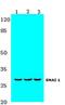 Snail Family Transcriptional Repressor 1 antibody, A00716-1, Boster Biological Technology, Western Blot image 