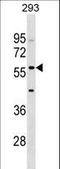 ISG-54 K antibody, LS-C165124, Lifespan Biosciences, Western Blot image 