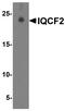 IQ Motif Containing F2 antibody, A19642, Boster Biological Technology, Western Blot image 