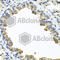 Serpin Family A Member 3 antibody, A1021, ABclonal Technology, Immunohistochemistry paraffin image 