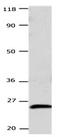 Casein Kinase 2 Beta antibody, orb107485, Biorbyt, Western Blot image 