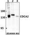 Cell Division Cycle Associated 2 antibody, A07293-1, Boster Biological Technology, Western Blot image 