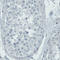 Thy-1 Cell Surface Antigen antibody, AMAb90844, Atlas Antibodies, Immunohistochemistry paraffin image 