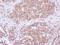 Arginyltransferase 1 antibody, NBP2-15495, Novus Biologicals, Immunohistochemistry paraffin image 