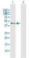 Interleukin 5 Receptor Subunit Alpha antibody, H00003568-B01P, Novus Biologicals, Western Blot image 