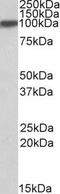 Aconitase 1 antibody, PA5-19157, Invitrogen Antibodies, Western Blot image 