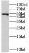 ST3 Beta-Galactoside Alpha-2,3-Sialyltransferase 6 antibody, FNab08267, FineTest, Western Blot image 