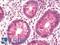 Nucleoporin 210 antibody, LS-C317934, Lifespan Biosciences, Immunohistochemistry paraffin image 