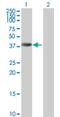 Ankyrin repeat domain-containing protein 1 antibody, H00027063-B01P, Novus Biologicals, Western Blot image 