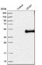 CD207 Molecule antibody, NBP1-84448, Novus Biologicals, Western Blot image 