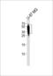 CD63 Molecule antibody, LS-B9475, Lifespan Biosciences, Western Blot image 