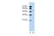 RNA Binding Motif Protein 22 antibody, PA5-41877, Invitrogen Antibodies, Western Blot image 