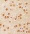 Sirtuin 1 antibody, MBS9210986, MyBioSource, Immunohistochemistry paraffin image 