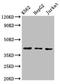 C-X-C Motif Chemokine Receptor 3 antibody, LS-C677628, Lifespan Biosciences, Western Blot image 