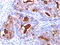 Carcinoembryonic Antigen Related Cell Adhesion Molecule 5 antibody, AM33326PU-S, Origene, Immunohistochemistry paraffin image 