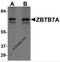 Zinc Finger And BTB Domain Containing 7A antibody, 6127, ProSci, Western Blot image 