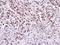 WEE1hu antibody, NBP1-33506, Novus Biologicals, Immunohistochemistry paraffin image 