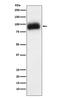 ADAM Metallopeptidase Domain 15 antibody, M02593-1, Boster Biological Technology, Western Blot image 