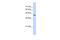 GA Binding Protein Transcription Factor Subunit Beta 1 antibody, 27-111, ProSci, Enzyme Linked Immunosorbent Assay image 