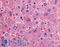 Dipeptidyl Peptidase 9 antibody, LS-A8312, Lifespan Biosciences, Immunohistochemistry paraffin image 