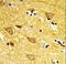 Inositol Polyphosphate-4-Phosphatase Type II B antibody, LS-C165246, Lifespan Biosciences, Immunohistochemistry paraffin image 