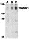 Mitogen-Activated Protein Kinase Kinase Kinase 5 antibody, 3677, ProSci Inc, Western Blot image 