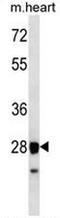 Syntaxin 8 antibody, AP54094PU-N, Origene, Western Blot image 
