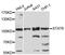 Signal Transducer And Activator Of Transcription 6 antibody, STJ25726, St John