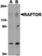 Regulatory Associated Protein Of MTOR Complex 1 antibody, PA5-20125, Invitrogen Antibodies, Western Blot image 