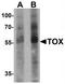 TOX antibody, TA319787, Origene, Western Blot image 