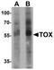 Thymocyte selection-associated high mobility group box protein TOX antibody, TA319787, Origene, Western Blot image 