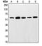 ETS Proto-Oncogene 1, Transcription Factor antibody, orb213907, Biorbyt, Western Blot image 