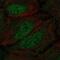 Doublecortin Like Kinase 1 antibody, NBP2-58700, Novus Biologicals, Immunocytochemistry image 