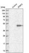 Zona Pellucida Binding Protein 2 antibody, NBP1-82689, Novus Biologicals, Western Blot image 