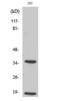 Caspase 6 antibody, GTX17383, GeneTex, Western Blot image 