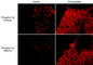Phosphotyrosine antibody, PM3751, ECM Biosciences, Immunocytochemistry image 