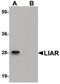 LIAR antibody, PA5-20778, Invitrogen Antibodies, Western Blot image 