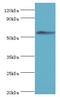 Chaperonin Containing TCP1 Subunit 3 antibody, LS-C375406, Lifespan Biosciences, Western Blot image 